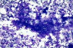 Non-Gyn Smear Diff-Quik 10x