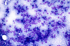 Non-Gyn Smear Diff-Quik 40x