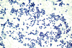 Non-Gyn Smear Pap Stain 40x