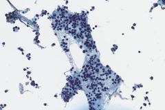 ThinPrep® Non Gyn, 20x