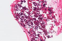 Cell Block, H&E, 20x