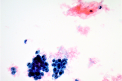 ThinPrep® Pap Test 40x