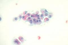 Non-Gyn Smear 40x