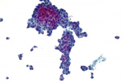 ThinPrep® Non-Gyn 20x