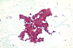 Non-Gyn Smear 10x