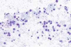 Smear, Pap Stain 20x