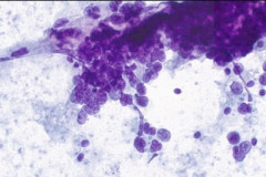 Smear, Pap Stain 40x