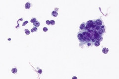 ThinPrep® Non Gyn 40x