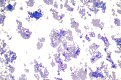 Non-Gyn Smear Diff-Quik 10x