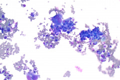 Non-Gyn Smear Diff-Quik 20x