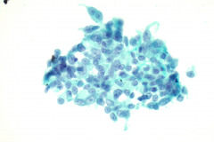 Non-Gyn Smear Pap Stain  40x
