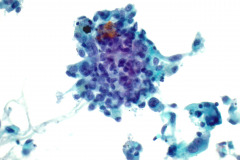 ThinPrep® Non-Gyn 40x