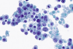 ThinPrep® Non Gyn 40x