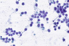 Smear, Pap Stain 40x