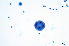 ThinPrep® Non-Gyn 40x