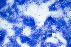 Modified Romanowsky Smear, 10x