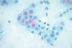 Pap Stain Smear, 40x