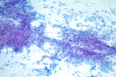 Non-Gyn smear Pap stain 10x