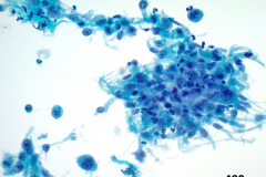 ThinPrep® Non-Gyn 40x