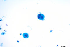 ThinPrep® Non-Gyn 40x