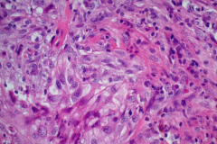 Biopsy H&E stain 40x