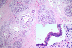 Resection, H&E 10x, Inset 40x