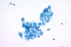 ThinPrep® Non-Gyn 40x