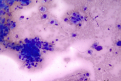 Air dried Diff-Quik stain 20x