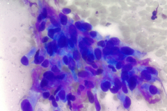 Air dried Diff-Quik stain 40x